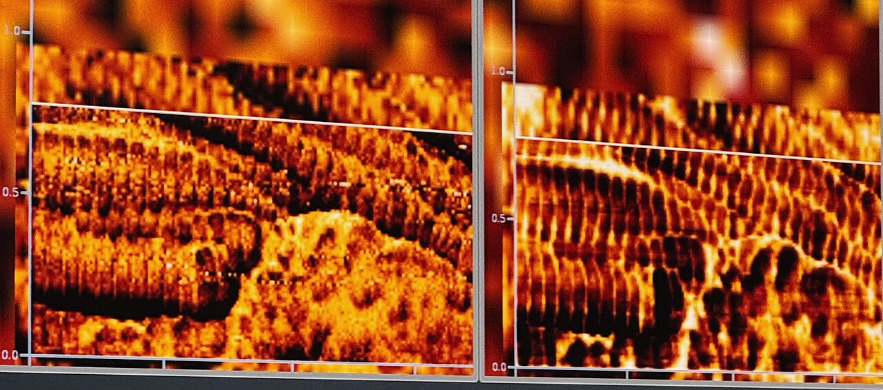 FM Collagen.jpg